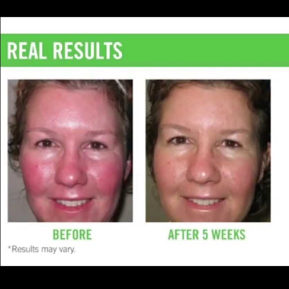 BRAND NEW Rodan and Fields “Soothe” Regimen - Picture 3 of 3